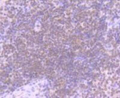 Immunohistochemistry-Paraffin: STIM1 Antibody (SD0814) [NBP2-67784] - Analysis of paraffin-embedded human spleen tissue using anti-STIM1 antibody. Counter stained with hematoxylin.