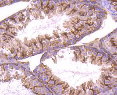 Immunohistochemistry-Paraffin: STIM1 Antibody (SD0814) [NBP2-67784] - Analysis of paraffin-embedded mouse testis tissue using anti-STIM1 antibody. Counter stained with hematoxylin.