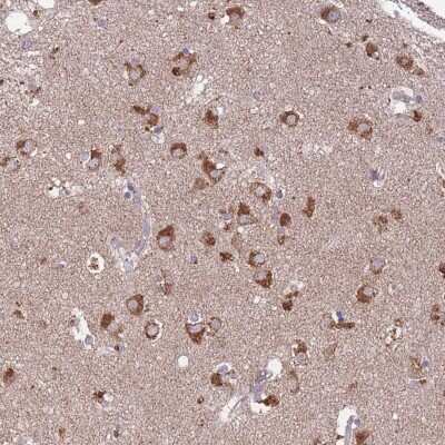 Immunohistochemistry: STIM2 Antibody [NBP2-37882] - Staining of human lateral ventricle shows strong cytoplasmic positivity in neuronal cells.