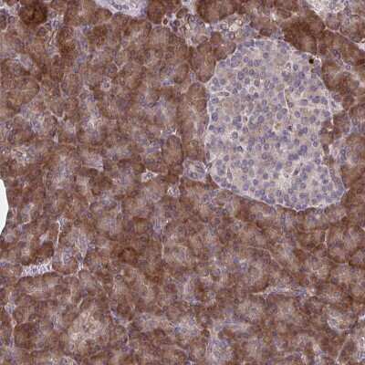 Immunohistochemistry: STIM2 Antibody [NBP2-37964] - Staining of human pancreas shows strong cytoplasmic positivity in exocrine glandular cells.