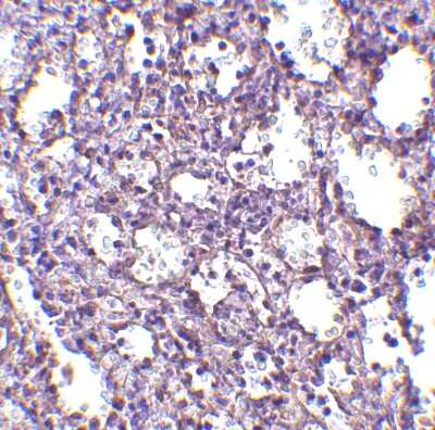 Immunohistochemistry-Paraffin: STIM2 Antibody [NBP1-76791] - Human spleen tissue with STIM2 antibody at 2.5 ug/ml.