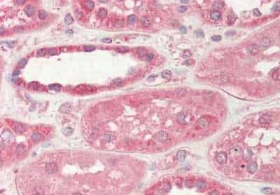 Immunohistochemistry-Paraffin: STIM2 Antibody [NBP2-44170] - Staining of human Kidney tissue: