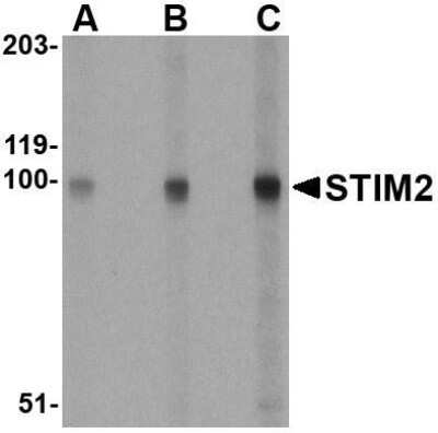 Western Blot: STIM2 Antibody [NBP1-76791] - A-20 cell lysate with STIM2 antibody at (A) 0.5, (B) 1 and (C) 2 ug/mL.