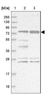 Western Blot: STIM2 Antibody [NBP2-37882] - Lane 1: Marker  [kDa] 250, 130, 95, 72, 55, 36, 28, 17, 10.  Lane 2: Human cell line RT-4.  Lane 3: Human cell line U-251MG