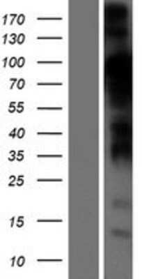 Western Blot STIM2 Overexpression Lysate