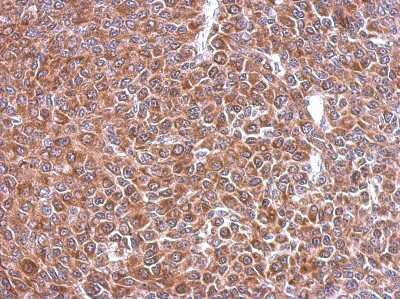 Immunohistochemistry-Paraffin: STIP1 Antibody [NBP2-20512] - Immunohistochemical analysis of paraffin-embedded BT483 xenograft, using antibody at 1:500 dilution.