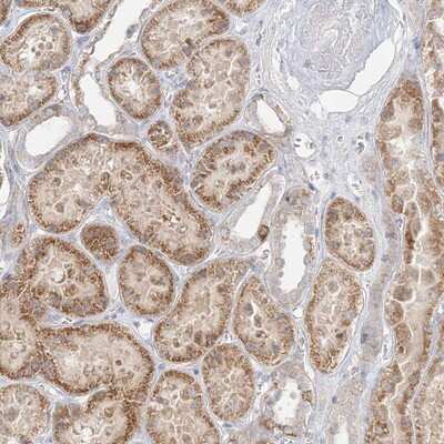 Immunohistochemistry-Paraffin STK11IP Antibody - BSA Free