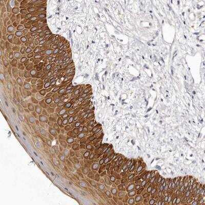 Immunohistochemistry-Paraffin STK16 Antibody - BSA Free