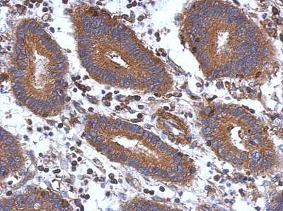 Immunohistochemistry-Paraffin STK16 Antibody - BSA Free
