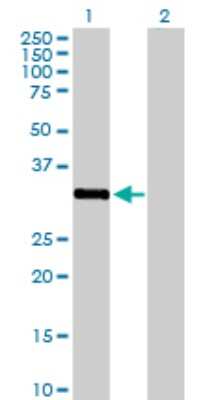 Western Blot: STK16 Antibody [H00008576-D01P] - Analysis of STK16 expression in transfected 293T cell line by STK16 polyclonal antibody.Lane 1: STK16 transfected lysate(34.70 KDa).Lane 2: Non-transfected lysate.