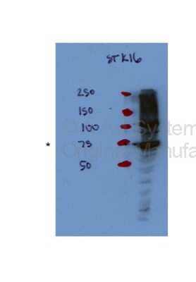 Western Blot: STK16 Antibody [NBP1-56541] - STK16 antibody - middle region validated by WB using Hek 293T Cells at 1:1000.