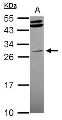 Western Blot STK16 Antibody - BSA Free
