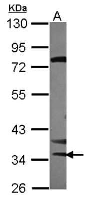 Western Blot: STK16 Antibody [NBP2-20514] - Sample (30 ug of whole cell lysate) A: U87-MG 10% SDS PAGE gel, diluted at 1:1000.