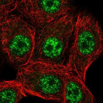 Immunocytochemistry/Immunofluorescence: STK19 Antibody [NBP2-57152] - Staining of human cell line MCF7 shows localization to nuclear speckles.