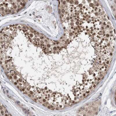 Immunohistochemistry-Paraffin: STK19 Antibody [NBP1-84308] - Staining of human testis shows strong nuclear positivity in cells in seminiferous ducts.