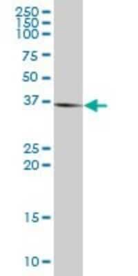 Western Blot: STK19 Antibody [H00008859-B01P] - Analysis of STK19 expression in human liver.