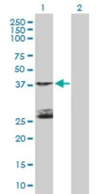 Western Blot: STK19 Antibody [H00008859-B01P] - Analysis of STK19 expression in transfected 293T cell line by STK19 polyclonal antibody.  Lane 1: STK19 transfected lysate(40.04 KDa). Lane 2: Non-transfected lysate.