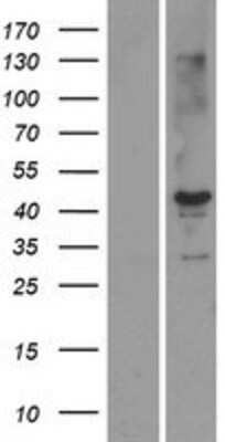 Western Blot STK19 Overexpression Lysate