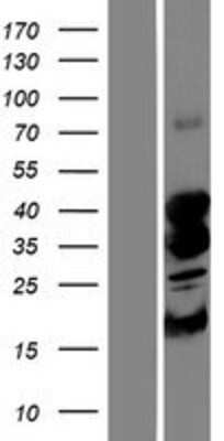 Western Blot STK19 Overexpression Lysate