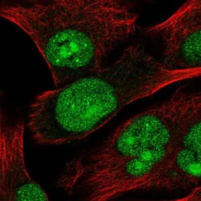 Immunocytochemistry/ Immunofluorescence STK22C Antibody