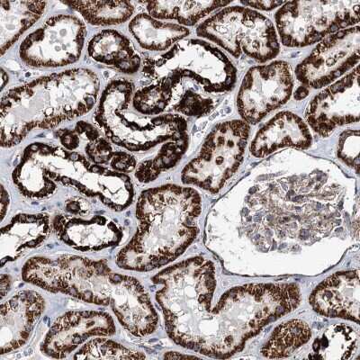 Immunohistochemistry-Paraffin: STK22C Antibody [NBP2-48674] - Staining of human kidney shows strong granular cytoplasmic positivity in cells in tubules.