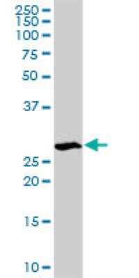 Western Blot STK22C Antibody