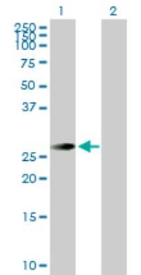 Western Blot STK22C Antibody