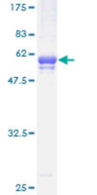 SDS-PAGE Recombinant Human STK22C GST (N-Term) Protein