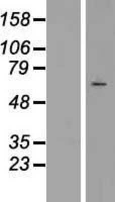Western Blot: STK23 Overexpression Lysate (Adult Normal) [NBP2-10326] Left-Empty vector transfected control cell lysate (HEK293 cell lysate); Right -Over-expression Lysate for STK23.