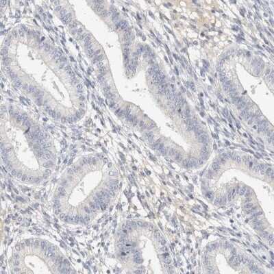 Immunohistochemistry-Paraffin: STK31 Antibody [NBP1-80759] - Staining of human endometrium shows low expression as expected.