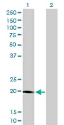 Western Blot: STK32A Antibody (3E8-1D3) [H00202374-M01] - Analysis of STK32A expression in transfected 293T cell line by STK32A monoclonal antibody (M01), clone 3E8-1D3.Lane 1: STK32A transfected lysate(19.8 KDa).Lane 2: Non-transfected lysate.