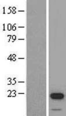 Western Blot: STK32A Overexpression Lysate (Adult Normal) [NBL1-16549] Left-Empty vector transfected control cell lysate (HEK293 cell lysate); Right -Over-expression Lysate for STK32A.