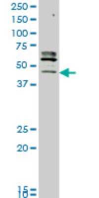 Western Blot: STK32C Antibody (3E8) [H00282974-M05] - Analysis of STK32C expression in MCF-7 (Cat # L046V1).