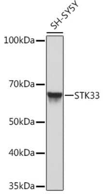 Western Blot: STK33 Antibody (1E4W7) [NBP3-15926] - Western blot analysis of extracts of SH-SY5Y cells, using STK33 Rabbit mAb (NBP3-15926) at 1:1000 dilution. Secondary antibody: HRP Goat Anti-Rabbit IgG (H+L) at 1:10000 dilution. Lysates/proteins: 25ug per lane. Blocking buffer: 3% nonfat dry milk in TBST. Detection: ECL Basic Kit. Exposure time: 10s.