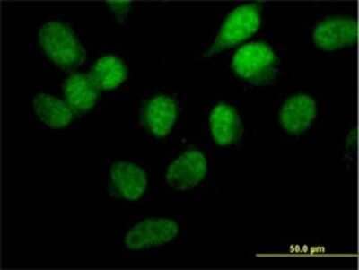 Immunocytochemistry/Immunofluorescence: STK33 Antibody (6G1) [H00065975-M02] - Analysis of monoclonal antibody to STK33 on HeLa cell. Antibody concentration 25 ug/ml.