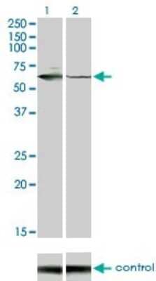 Western Blot: STK33 Antibody (6G1) [H00065975-M02] - Analysis of STK33 over-expressed 293 cell line, cotransfected with STK33 Validated Chimera RNAi ( Cat # H00065975-R01V ) (Lane 2) or non-transfected control (Lane 1). Blot probed with STK33 monoclonal antibody (M02) clone 6G1 (Cat # H00065975-M02 ). GAPDH ( 36.1 kDa ) used as specificity and loading control.