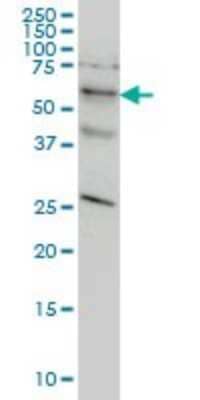 Western Blot: STK33 Antibody (6G1) [H00065975-M02] - STK33 monoclonal antibody (M02), clone 6G1 Analysis of STK33 expression in HeLa.