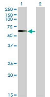 Western Blot: STK33 Antibody (6G1) [H00065975-M02] - Analysis of STK33 expression in transfected 293T cell line by STK33 monoclonal antibody (M02), clone 6G1.Lane 1: STK33 transfected lysate(57.9 KDa).Lane 2: Non-transfected lysate.