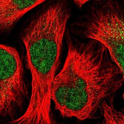 Immunocytochemistry/Immunofluorescence: STK33 Antibody [NBP2-58674] - Staining of human cell line U-2 OS shows localization to nucleus & cytosol.