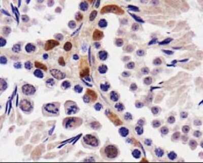 Immunohistochemistry: STK33 Antibody [NBP1-54156] - IHC staining of STK33 in mouse testis.