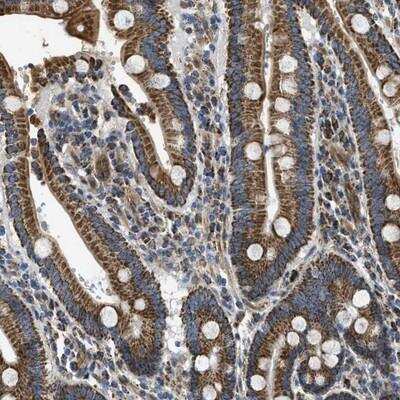 Immunohistochemistry: STK33 Antibody [NBP1-86069] - Staining of human duodenum shows granular cytoplasmic positivity in glandular cells.