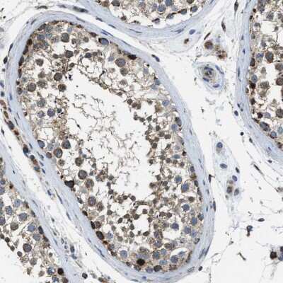 Immunohistochemistry-Paraffin: STK33 Antibody [NBP1-86069] - Staining of human testis shows strong cytoplasmic positivity in cells in seminiferous ducts.