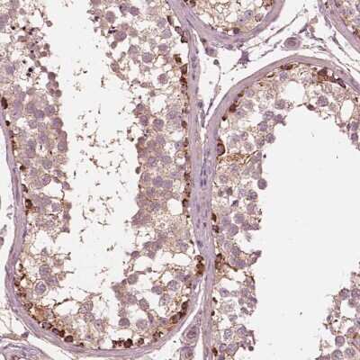 Immunohistochemistry-Paraffin: STK33 Antibody [NBP2-58674] - Staining of human testis shows strong cytoplasmic positivity in spermatogonia.