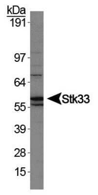 Western Blot: STK33 Antibody [NBP1-54156] - Detection of Stk33 in HEK293 cell lysate.