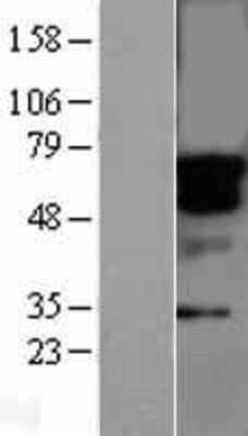 Western Blot STK33 Overexpression Lysate