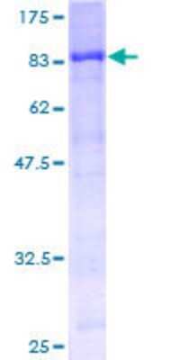 Western Blot Recombinant Human STK33 GST (N-Term) Protein