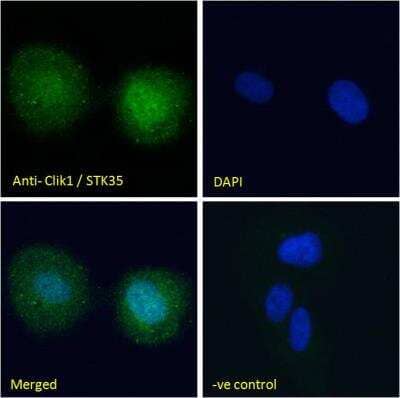 Immunocytochemistry/Immunofluorescence: STK35 Antibody [NB100-1393] - Analysis of paraformaldehyde fixed U2OS cells, permeabilized with 0.15% Triton. Primary incubation 1hr (10 ug/mL) followed by Alexa Fluor 488 secondary antibody (2 ug/mL), showing nuclear staining. The nuclear stain is DAPI (blue). Negative control: Unimmunized goat IgG (10 ug/mL) followed by Alexa Fluor 488 secondary antibody (2 ug/mL).