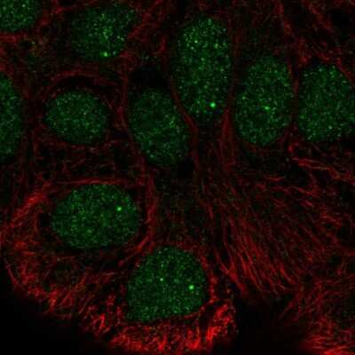 Immunocytochemistry/Immunofluorescence: STK35 Antibody [NBP2-55292] - Staining of human cell line HaCaT shows localization to nucleus & nuclear bodies.