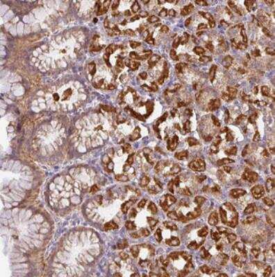 Immunohistochemistry: STK35 Antibody [NBP2-30644] - Staining of human stomach, upper shows strong cytoplasmic positivity in glandular cells.