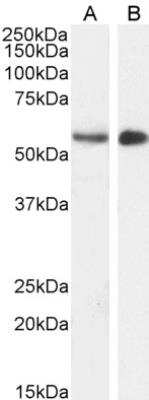 Western Blot: STK35 Antibody [NB100-1393] - Staining of Mouse with antibody at 1 ug/mL (A) and Pig with antibody at 2 ug/mL (B). Testes lysate (35 ug protein in RIPA buffer). Detected by chemiluminescence.